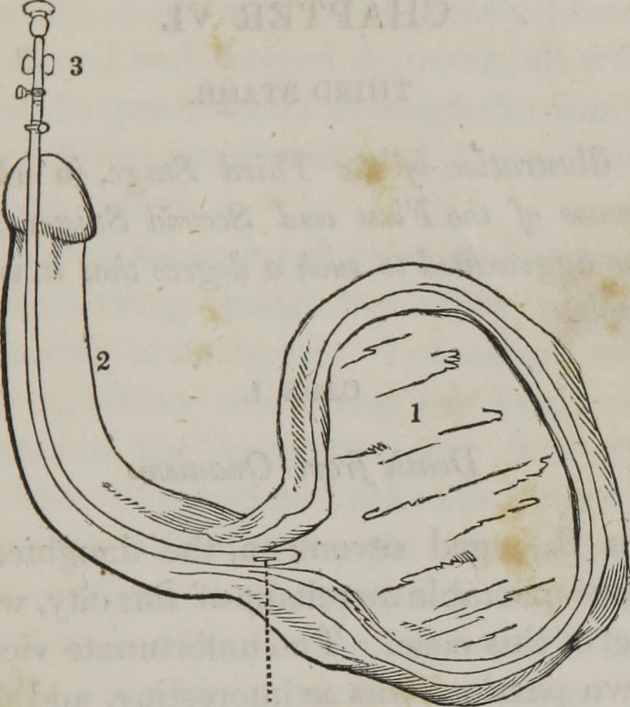 impotency meaning in hindi 1 impotency meaning in hindi