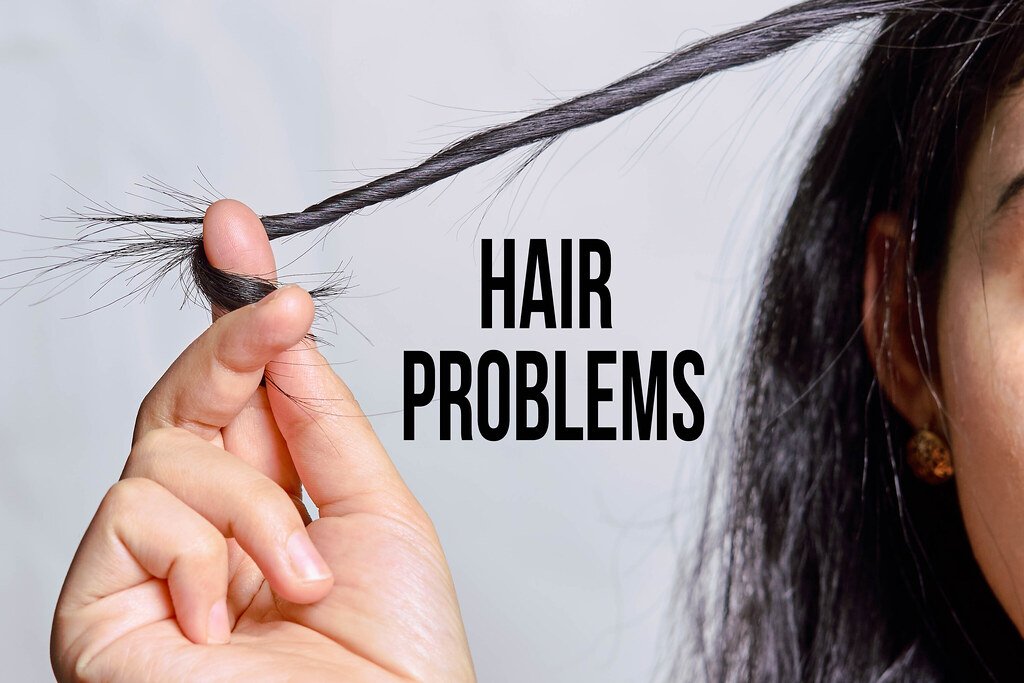 Siddha Medicine for Boosting Hair Growth and Preventing Hair Loss