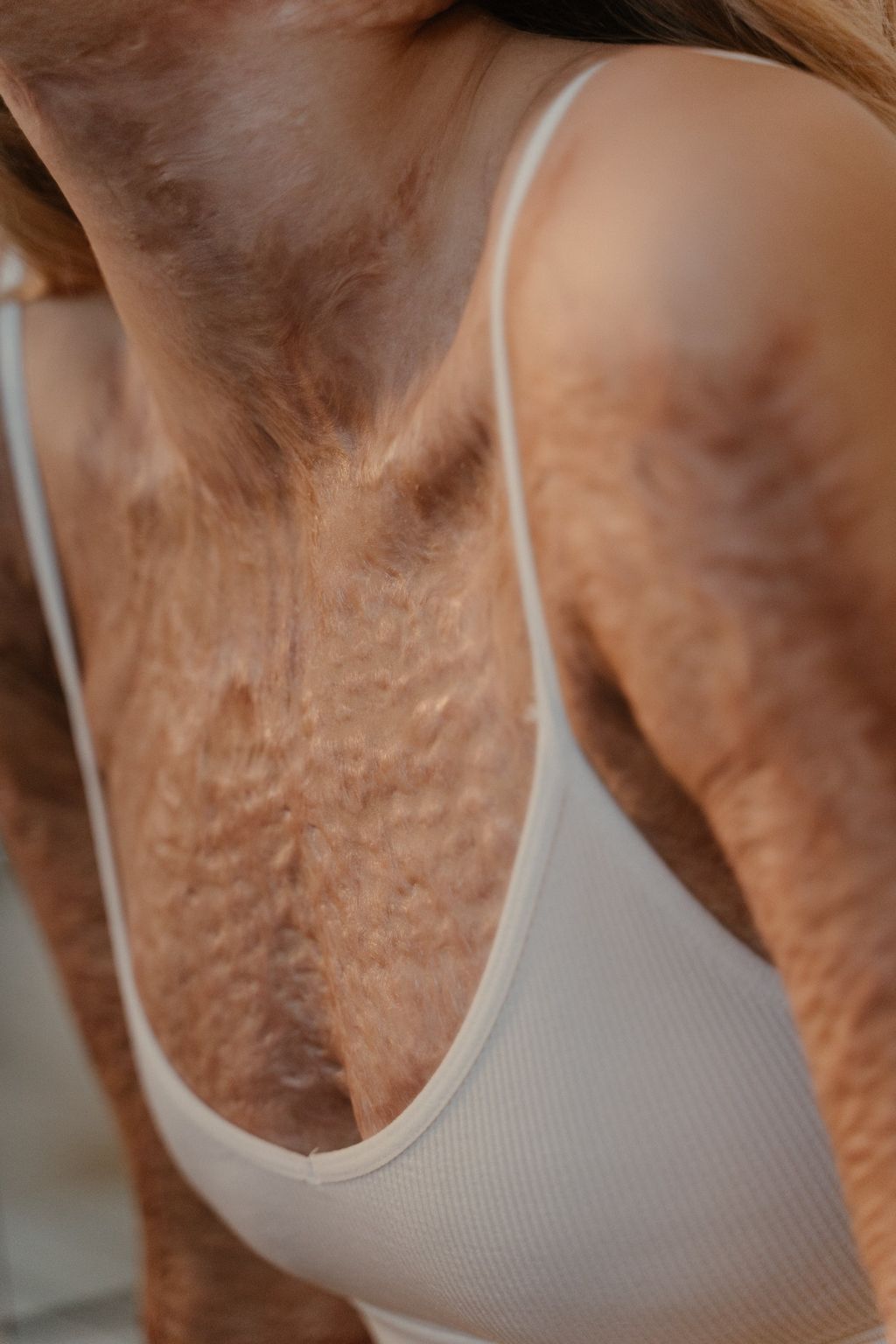 The Ultimate Review: Does No Marks Cream Truly Erase Skin Imperfections?