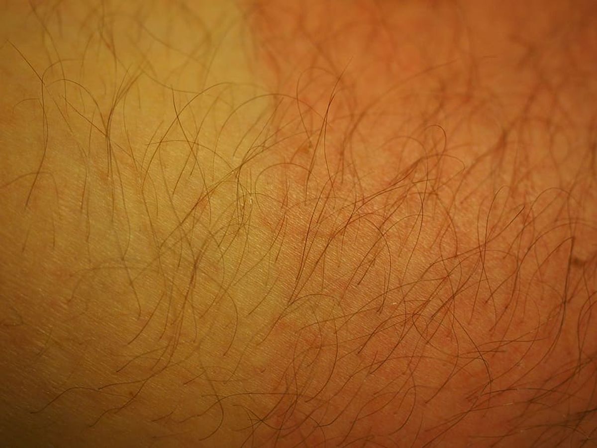 The Potential Pitfalls: Examining Kumkumadi Lepam Side Effects