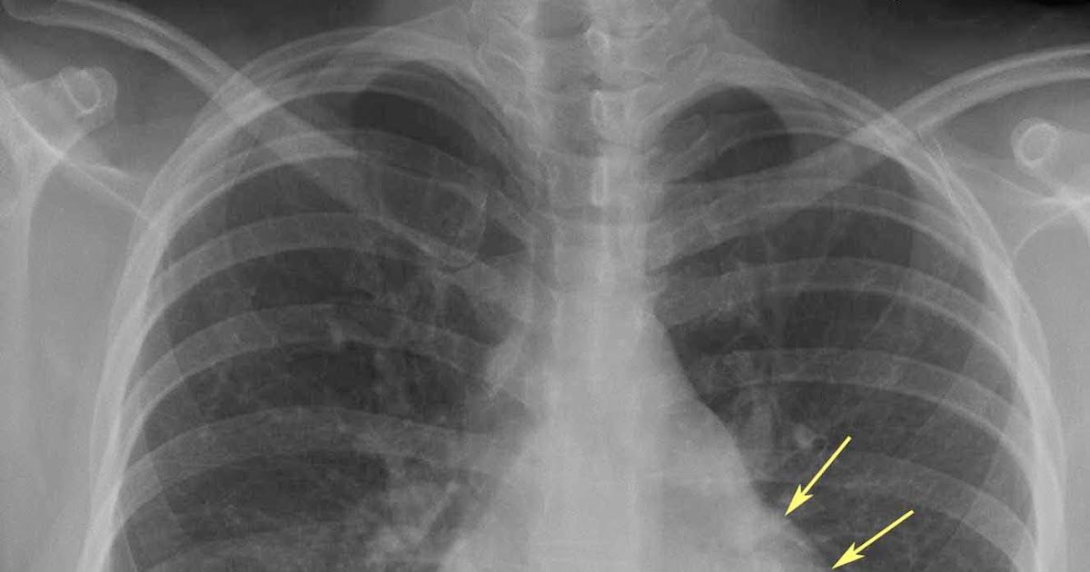 Safely Amplifying Your Curves: A Guide to Breast Size Increase Medicines 1 Safely Amplifying Your Curves: A Guide to Breast Size Increase Medicines