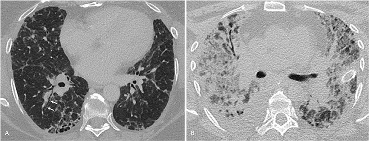 Unveiling the Efficacy of Rumartho Gold: A Comprehensive Review 1 Unveiling the Efficacy of Rumartho Gold: A Comprehensive Review