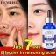 mxvdj_512.webp